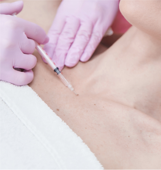 Escote